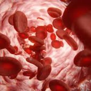 ارتباط بین HIV و کم خونی؟